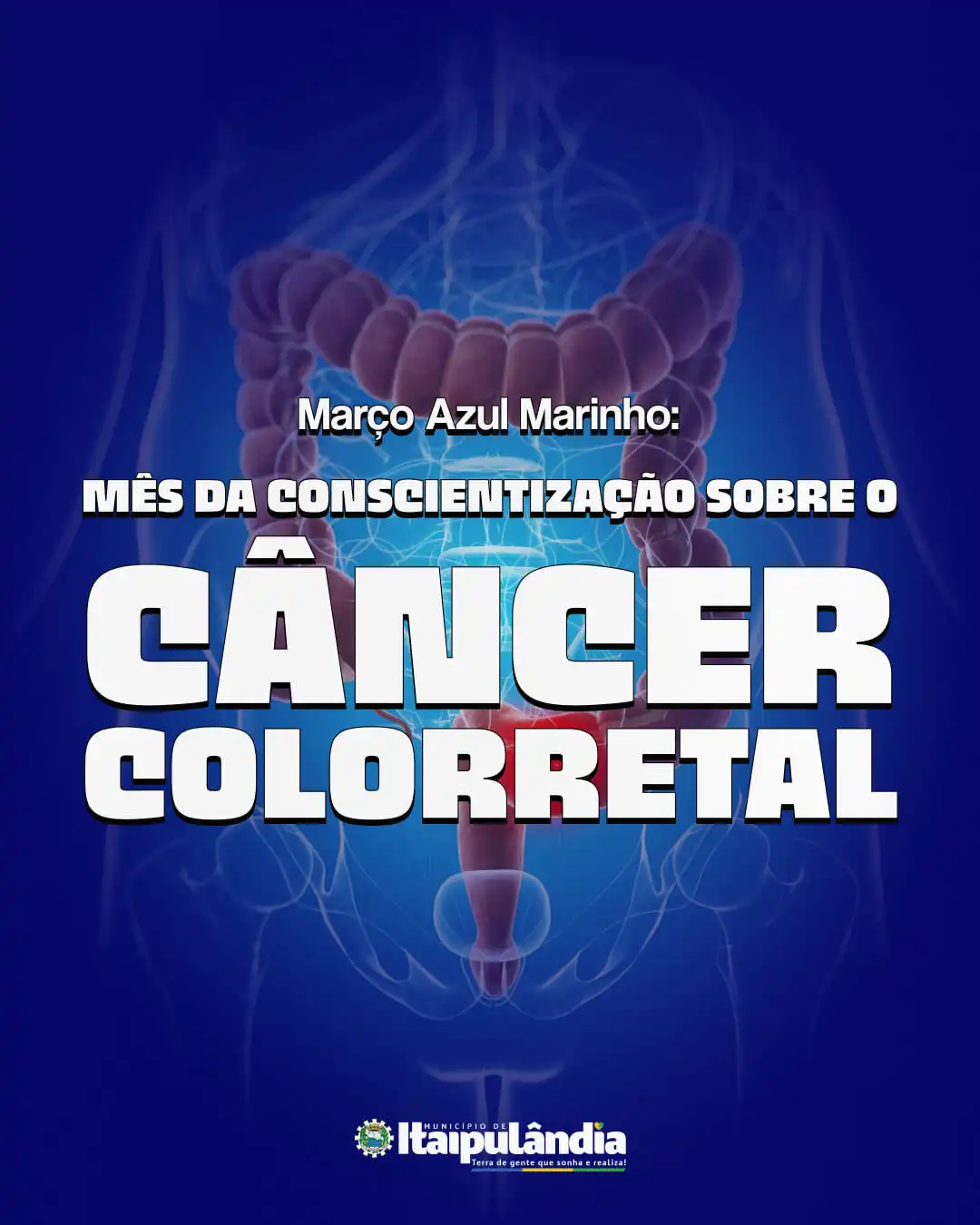 Câncer colorretal: conheça os fatores de risco e saiba como se prevenir